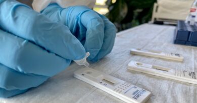 Tests antigéniques rapides COVID-19 disponibles pour les titulaires de cartes de concession, mais les pharmaciens craignent qu’il n’y en ait pas assez